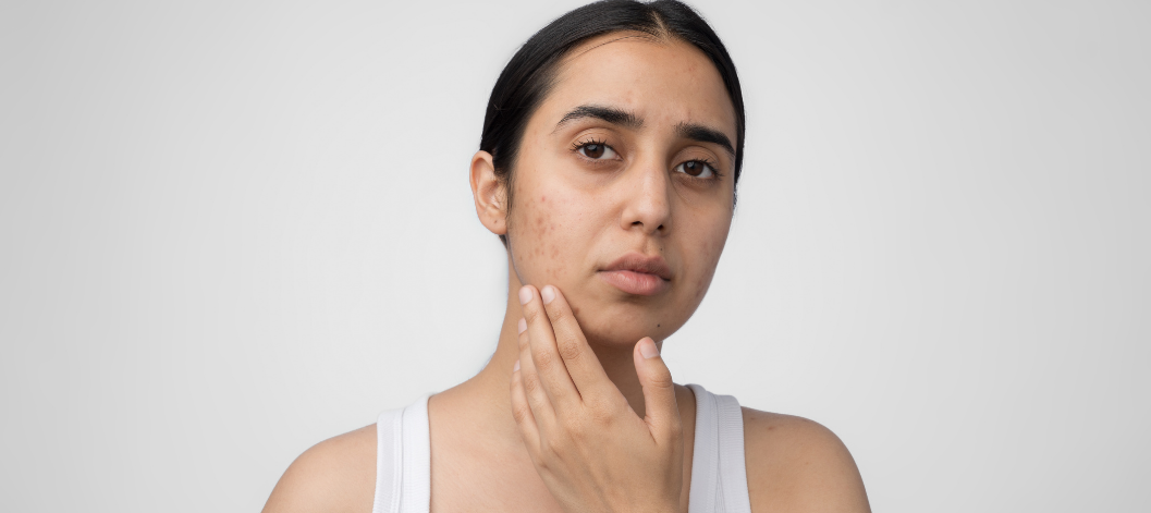 Daily habits that secretly make your skin look dull (backed by science) - Re'equil