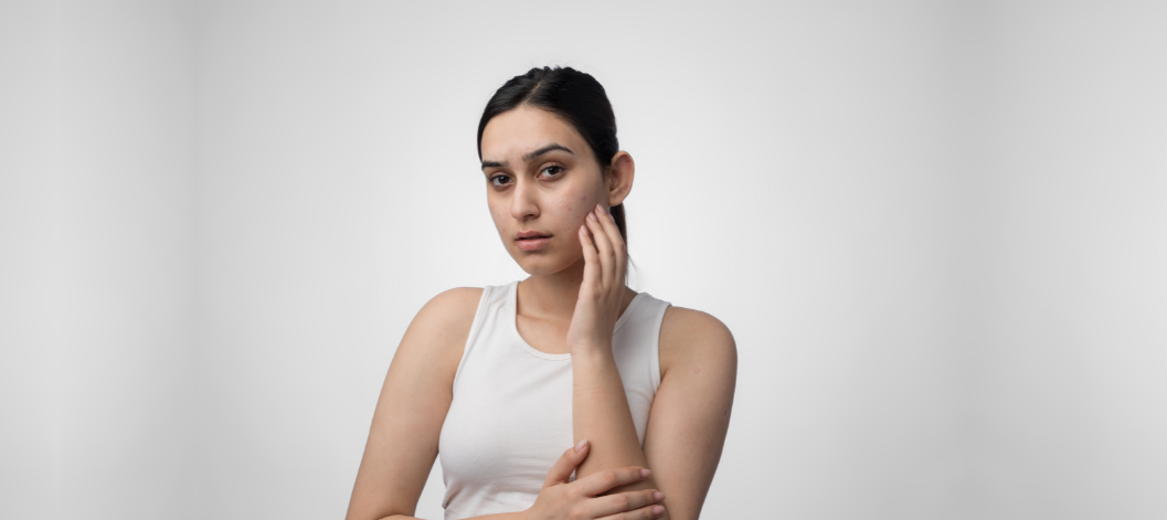 6 Harmful Ingredients That Trigger Acne – Discover What to Avoid on Labels - Re'equil