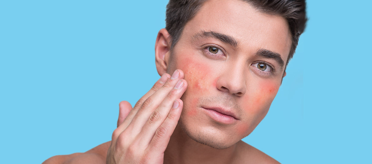 5 Ingredients To Avoid If You Have Sensitive Skin - Re'equil