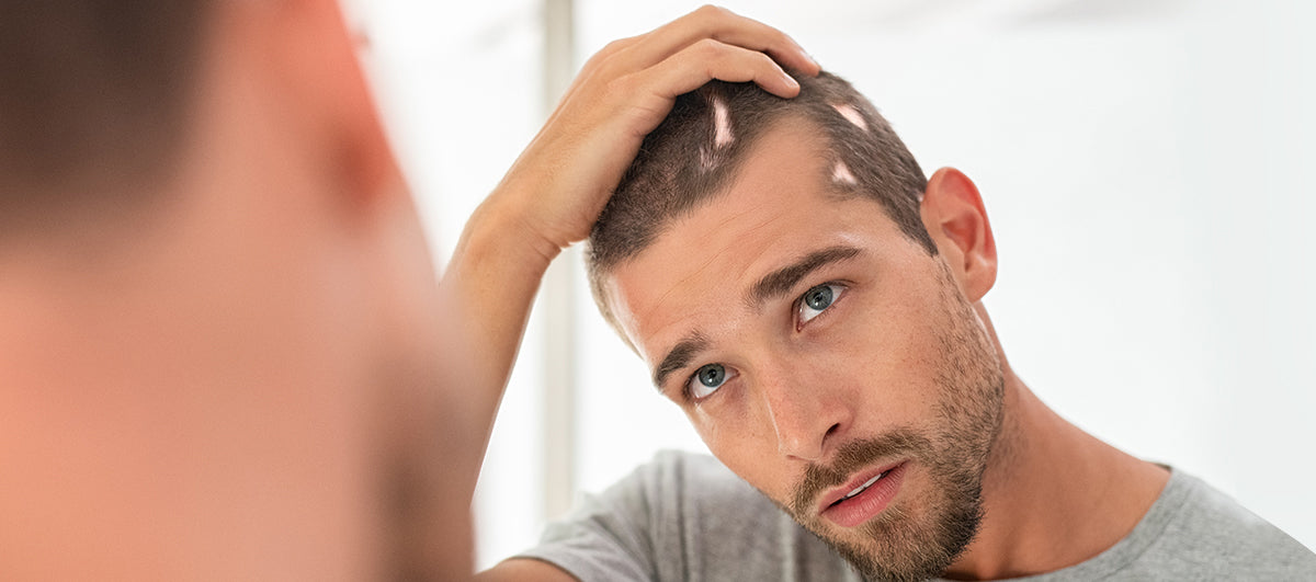 7 Best Hairstyles For Balding Men