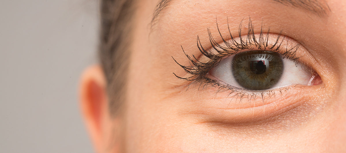 7 Effective Home Remedies For Puffy Eyes