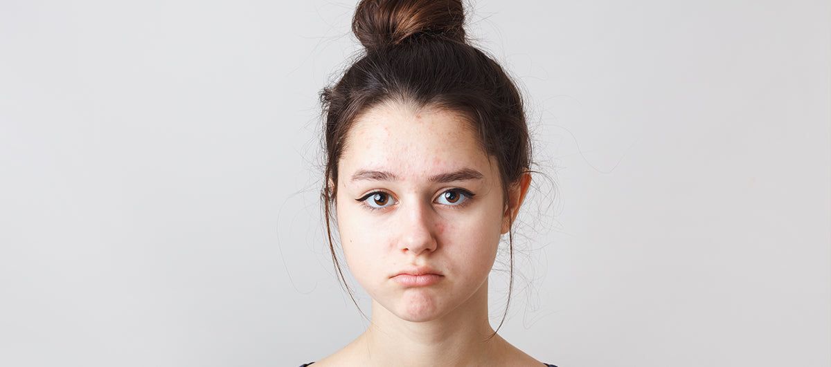 A Comprehensive Guide To Brighten Your Dull Skin