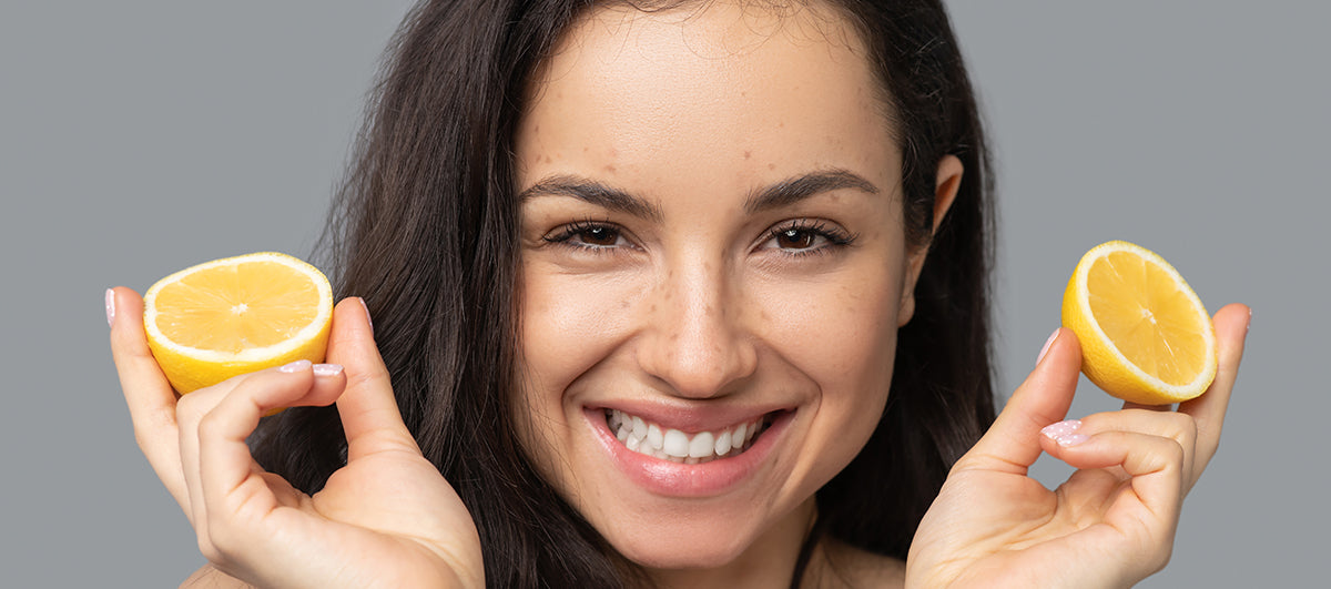 Benefits of Vitamin C for Skin