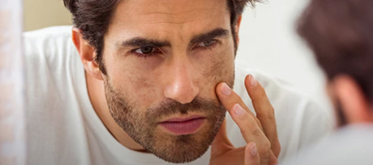 Clear Dark Spots and Melasma With These 6 Science Backed Ingredients - Re'equil