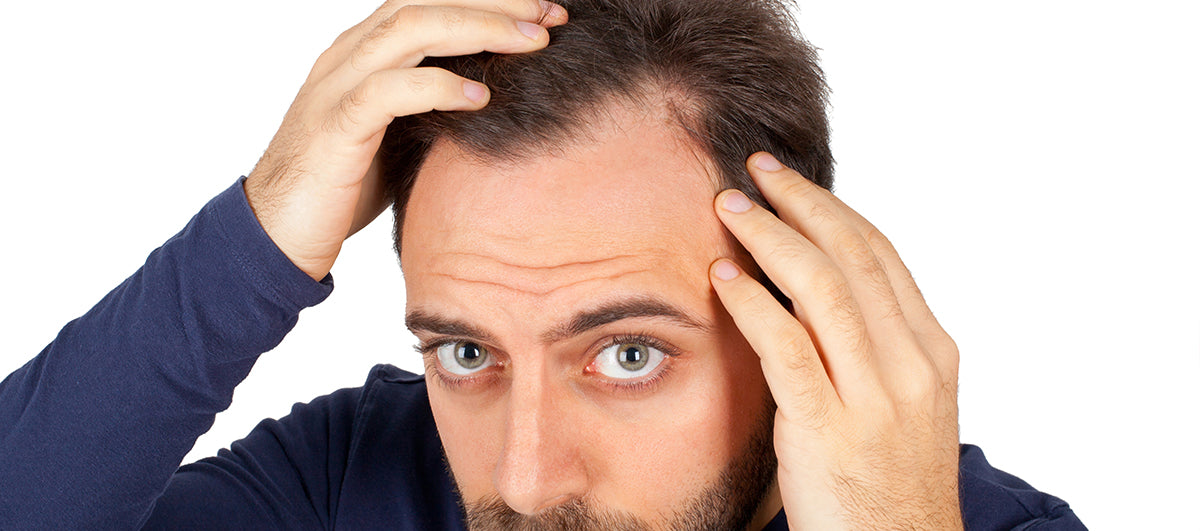 Best Ways To Deal With A Receding Hairline