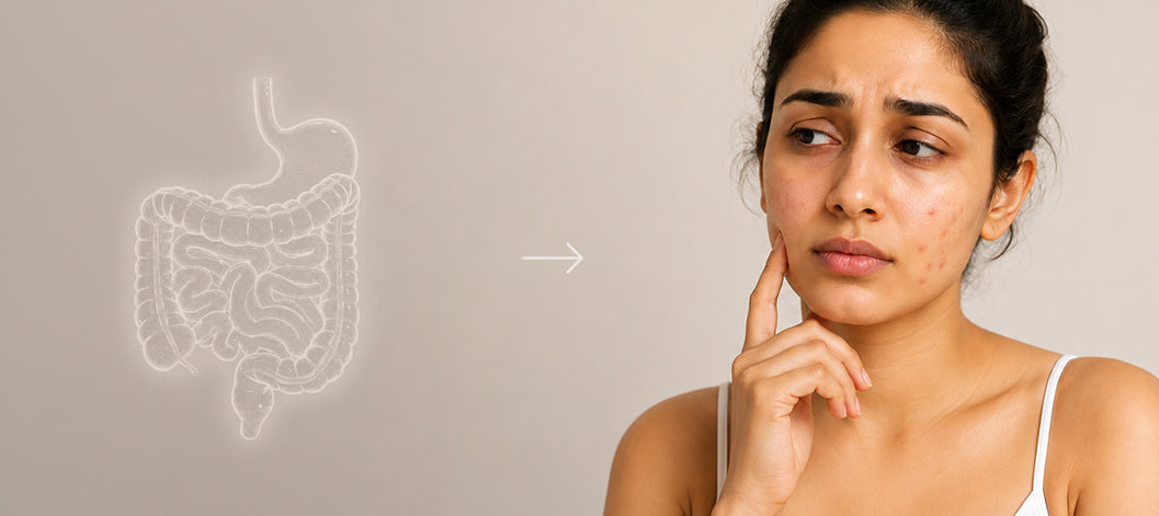 Skin-Gut Axis: Why is your gut health affecting your skin?
