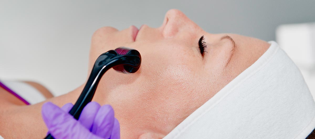 Dermaroller Treatment | Micro Needle Roller