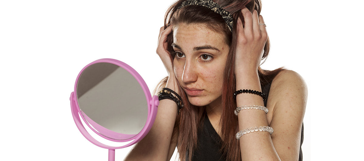 How to Get Rid of Stress Acne