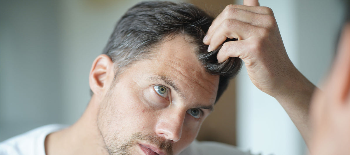 Home Remedies To Prevent Premature Greys