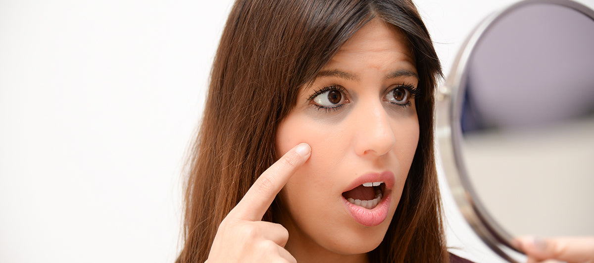 Home Remedy for Removing Dark Circles Under Eyes