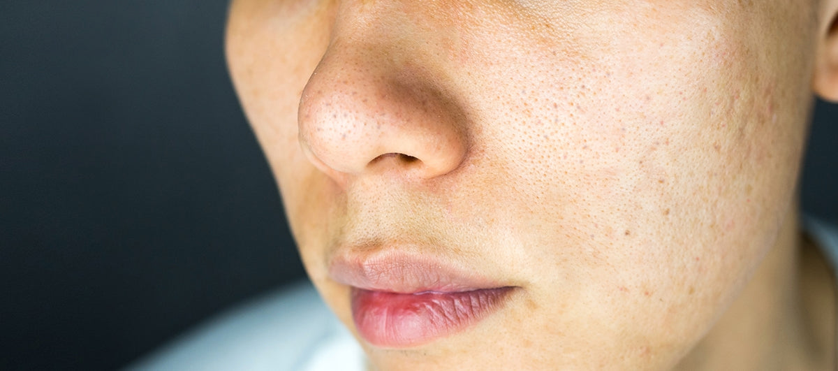 How To Reduce Pores On Face