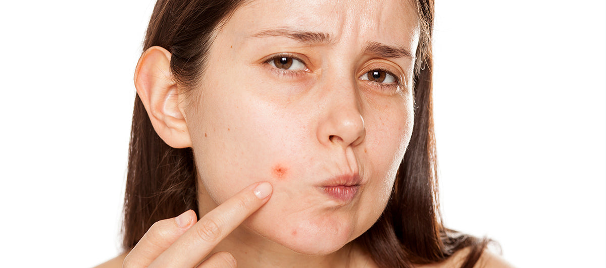 How To Prevent Skin Breakouts In Humid Weather?