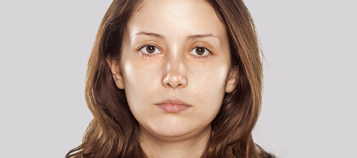 Skin Care 101: Ideal Moisturizing Ingredients For Oily Skin