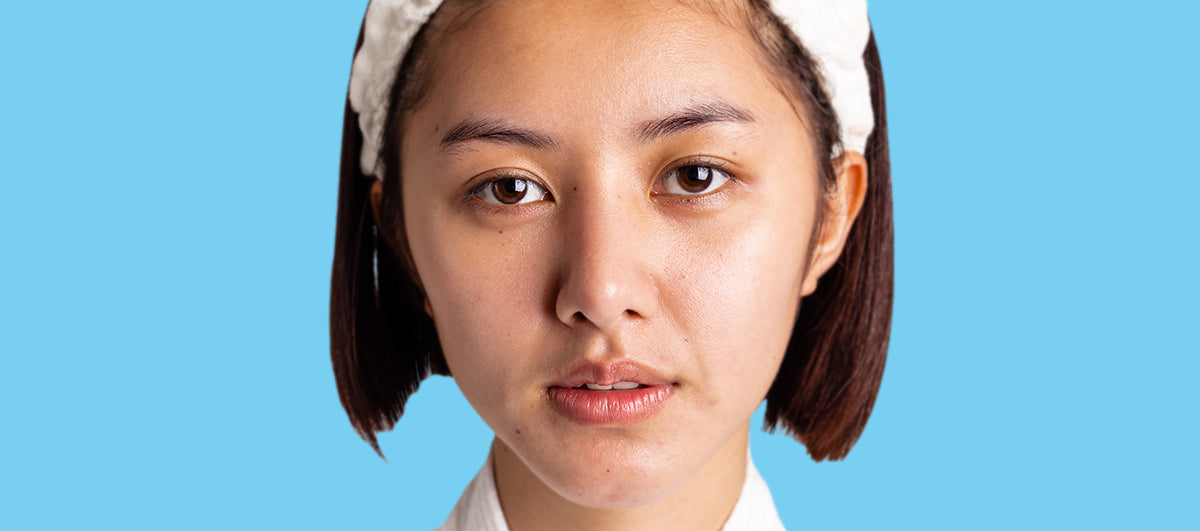 Know The Culprit Behind Dull Skin - Re'equil