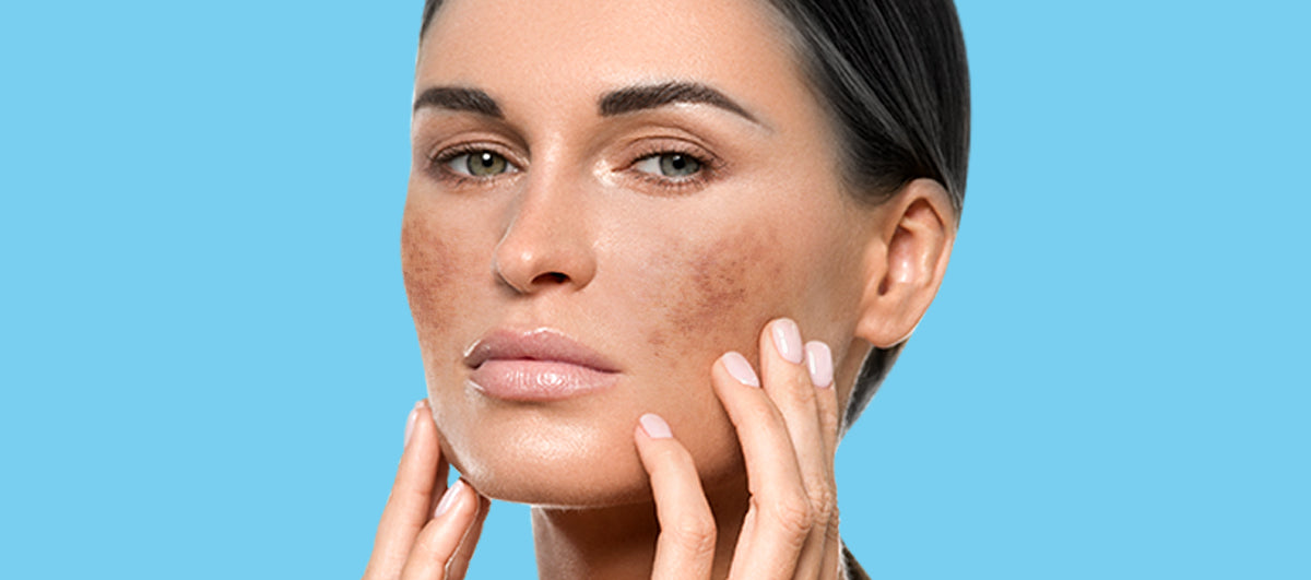 Licorice: One Stop Solution For Pigmentation