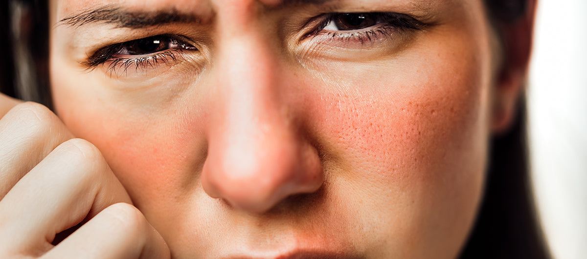 Sun Allergy Symptoms, Causes, And Treatment