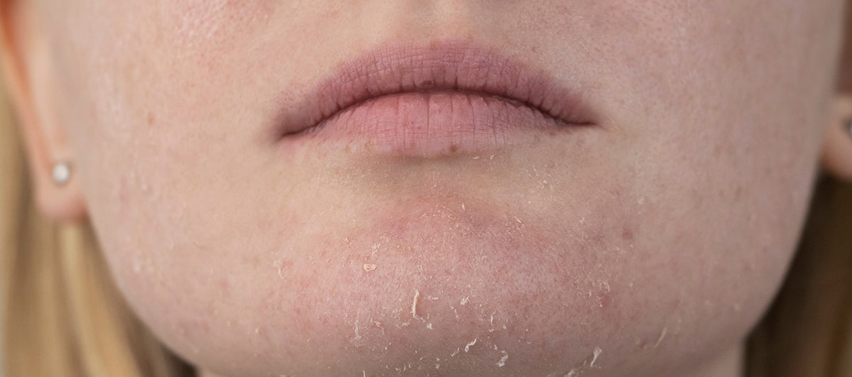 Top 12 Winter Skin Care Tips For Soft And Glowing Skin - Re'equil