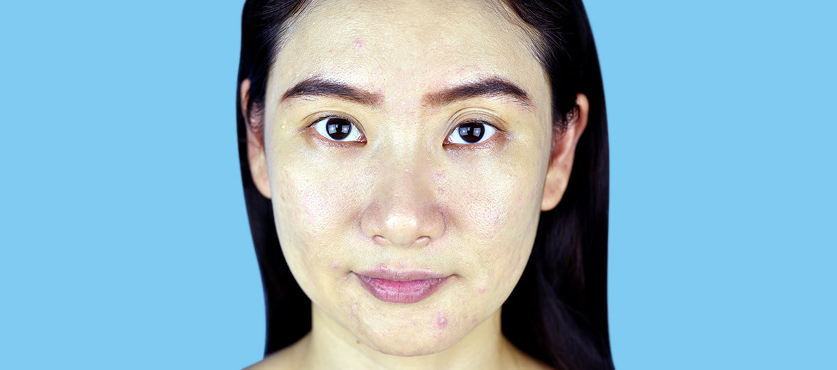 Ultimate Benefits Of Detox Water For Clear Skin