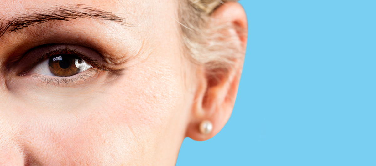 Ultimate Guide To Cure Dark Eyelids