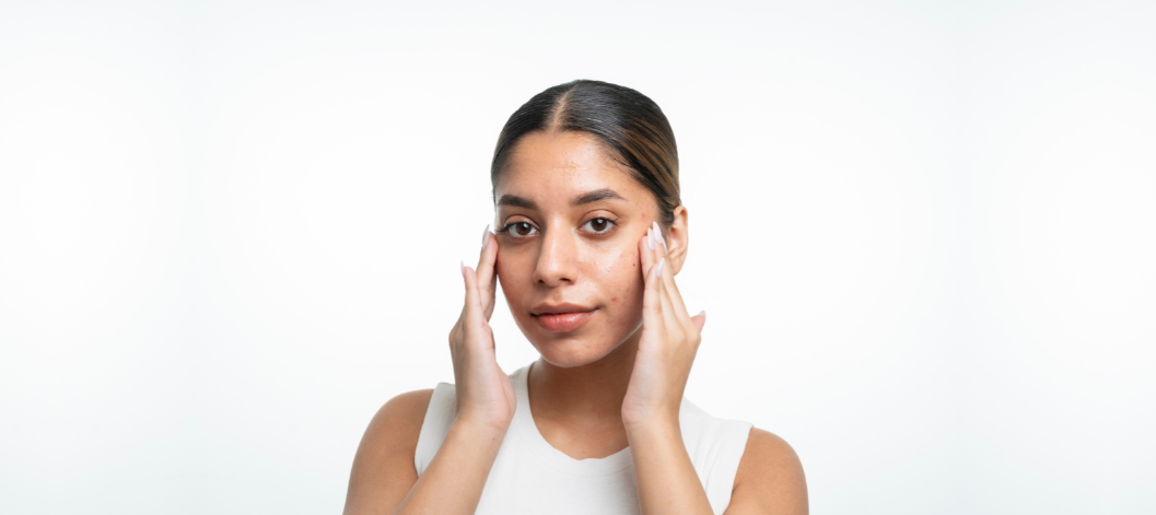 Is Vitamin C effective for oily, acne-prone skin? - Re'equil