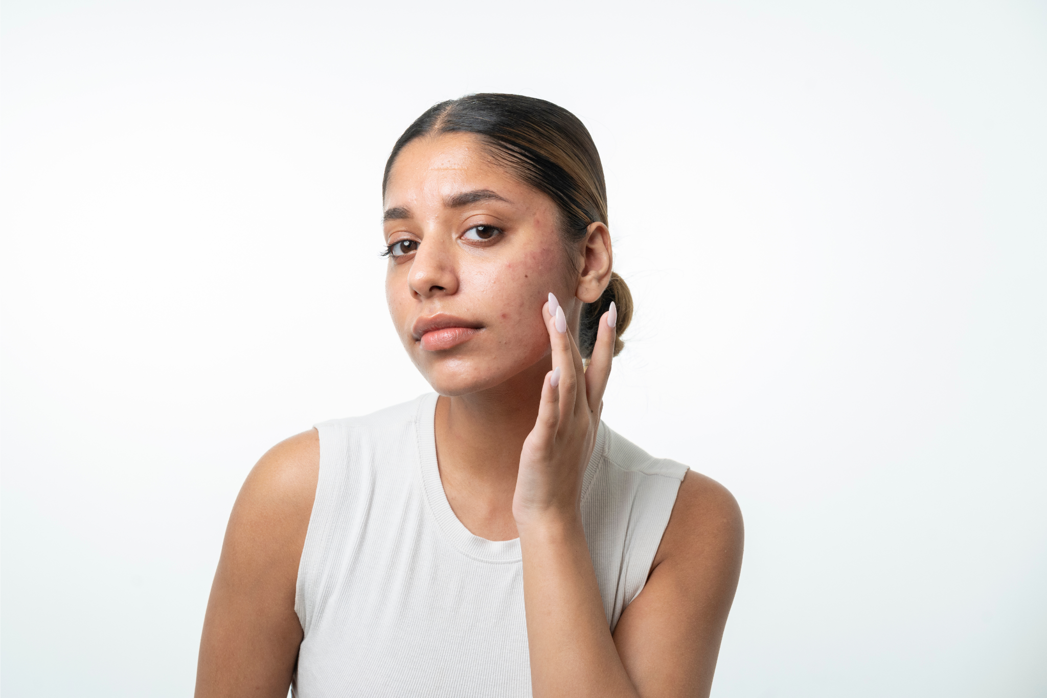 3 Skin Concerns Triggered by Stress (And how to manage them) - Re'equil