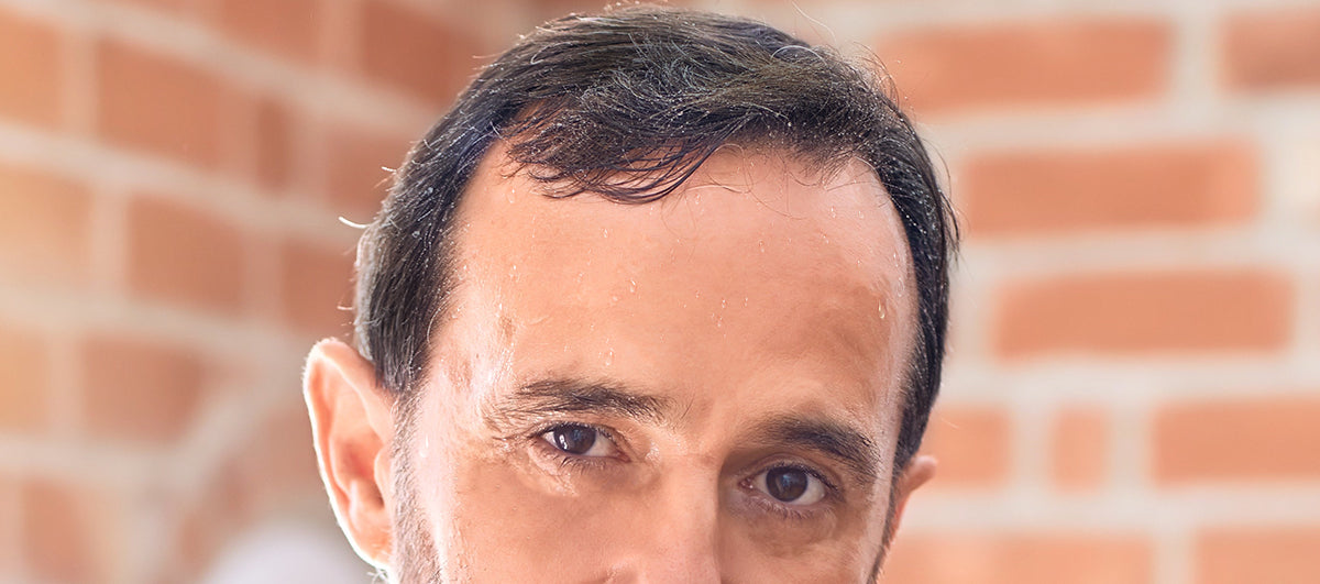 Can Sweating Lead To Hair Loss? - Re'equil