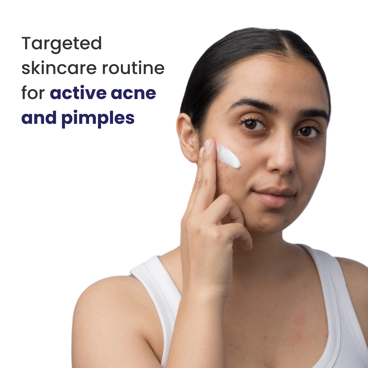 Acne Pimple Treatment Bundle