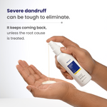 Reequil Dandruff Control Lotion