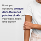 Unveil® Neck, Knee & Elbow Cream
