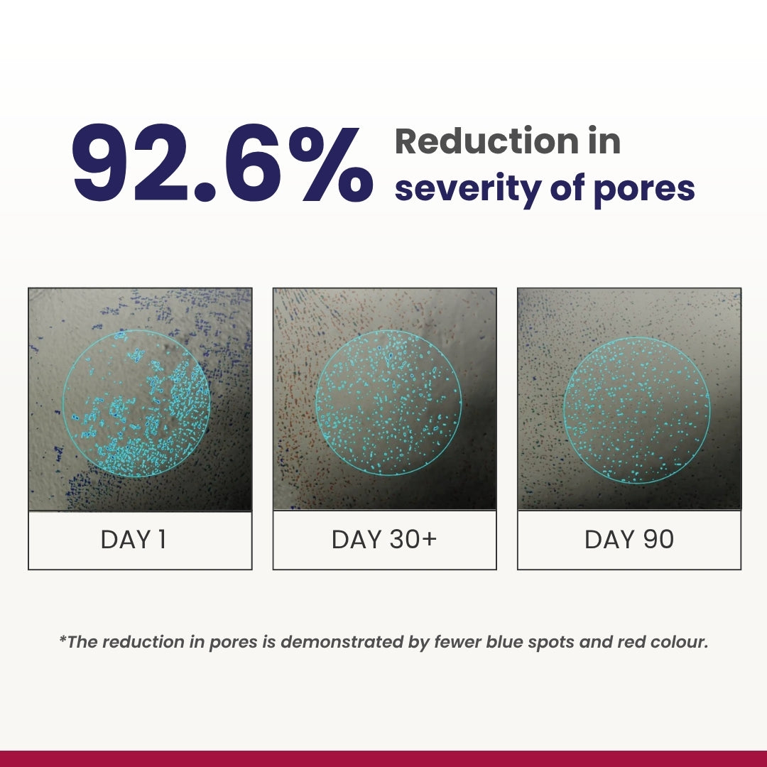 0.3% Retinol Night Cream