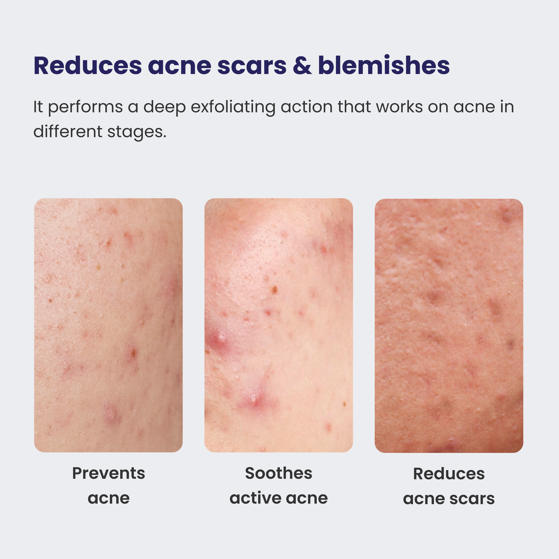 Reequil 0.5% Retinol Night Cream