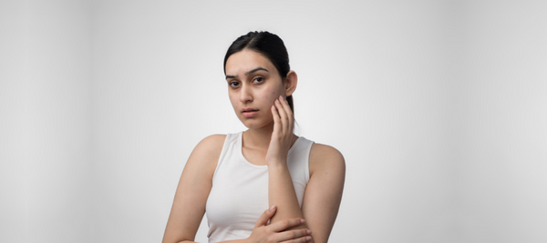 6 Harmful Ingredients That Trigger Acne – Discover What to Avoid on Labels
