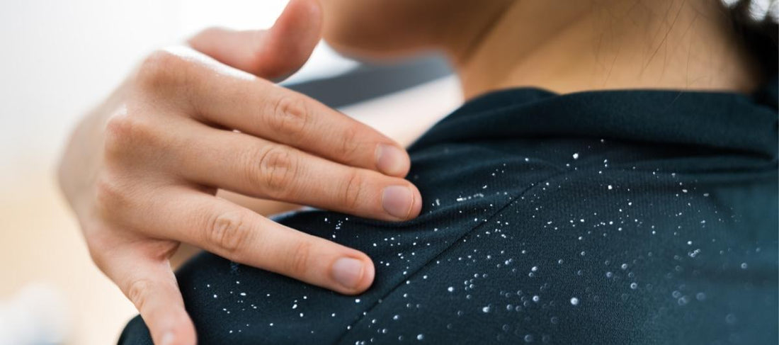 Dandruff 101: Causes and management with ingredients that work