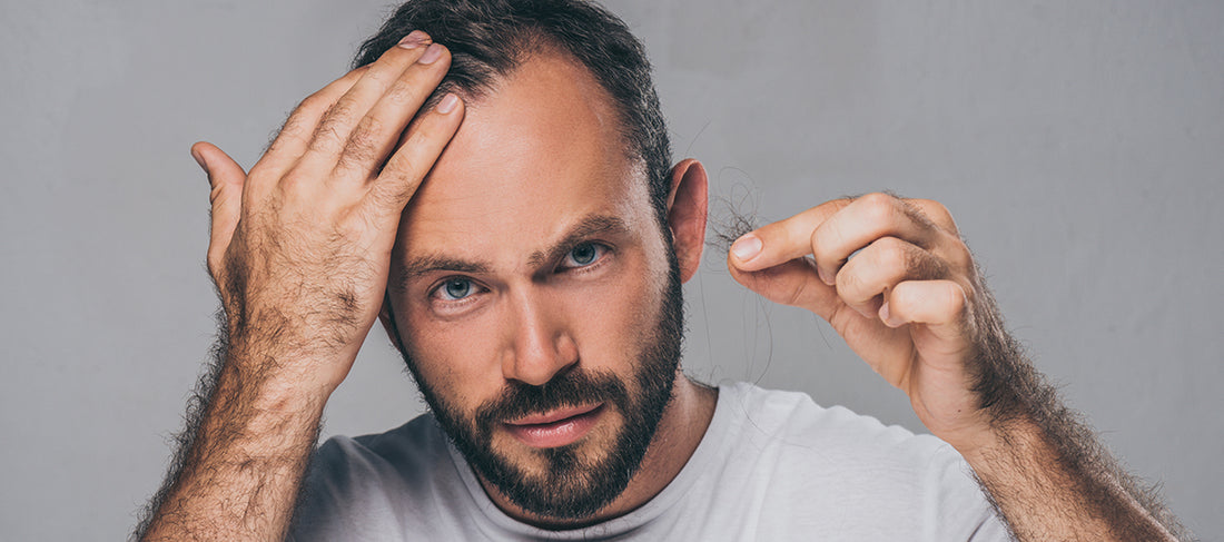 Aminexil Vs Minoxidil : Which Is Better For Hair Loss?