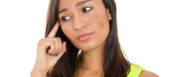 Unknown Habits That Trigger  Hyperpigmentation