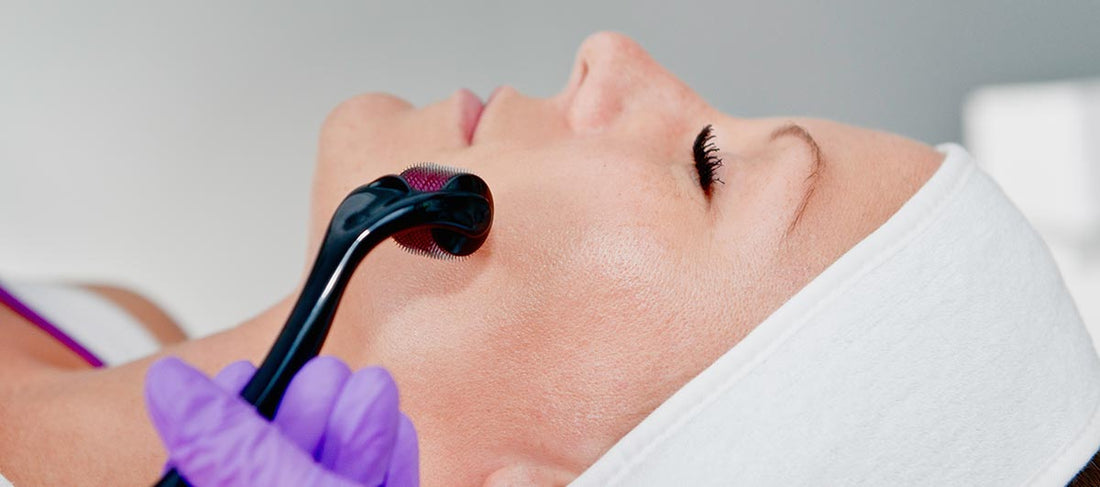 Dermaroller Treatment | Micro Needle Roller