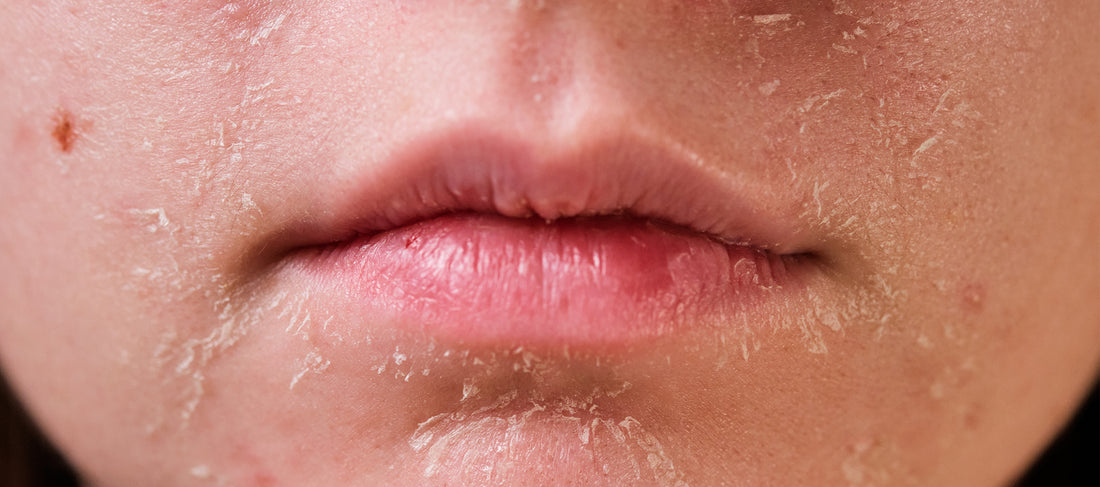 Discover 5 Effective Ingredients For Dry Skin