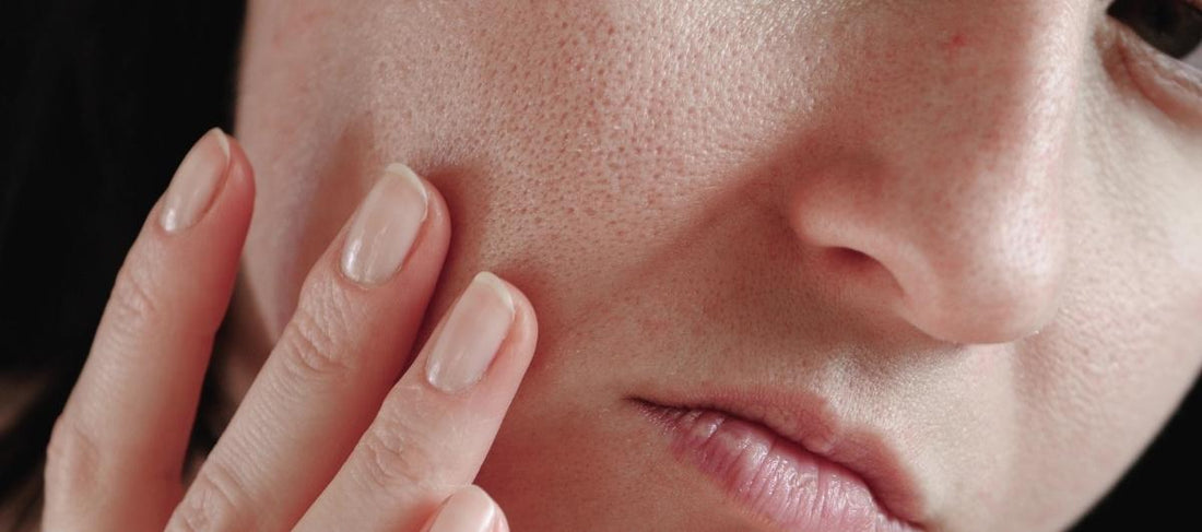 Find The Best Solution For Enlarged And Open Pores