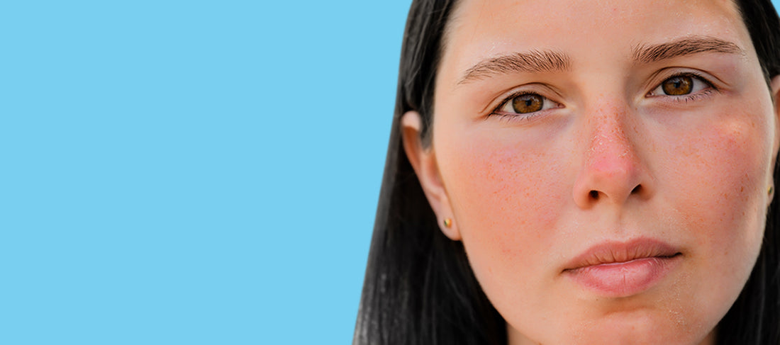 how to prevent skin tanning in summer