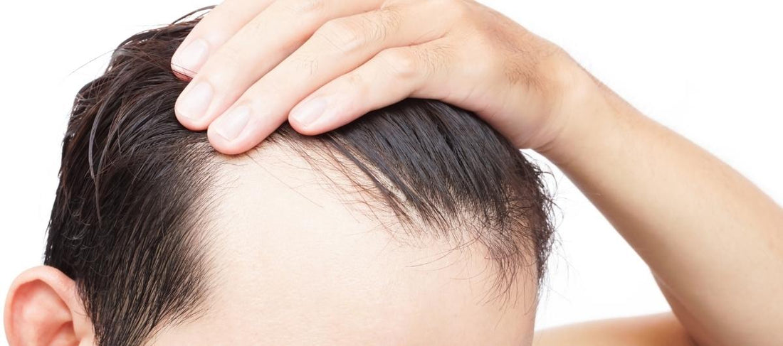 How to Stop Hair Fall? Causes, Treatments and Remedies