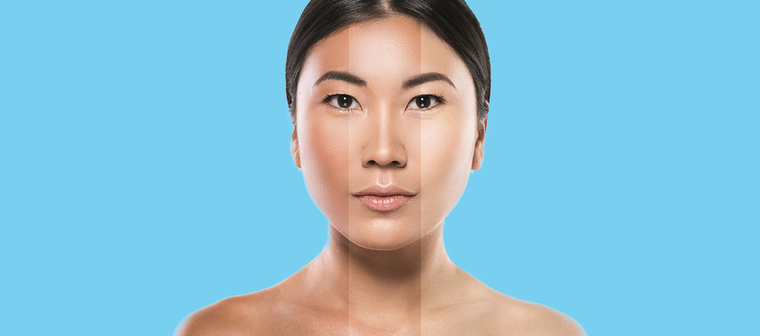 Is It Possible To Increase Or Decrease Melanin In Your Skin?