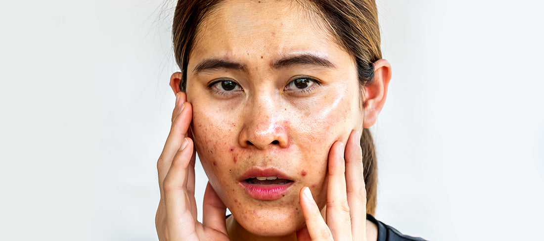 Oily Skin and Aging? Myth Debunked!