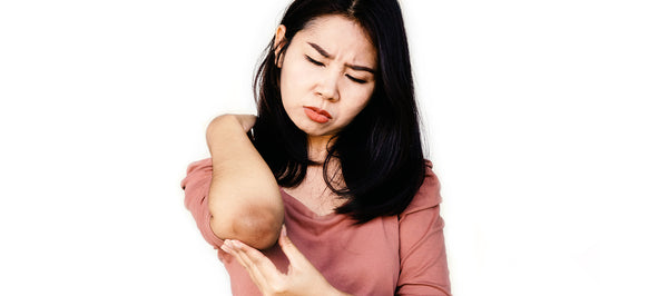 Natural Ways To Get Rid Of Dark Elbows