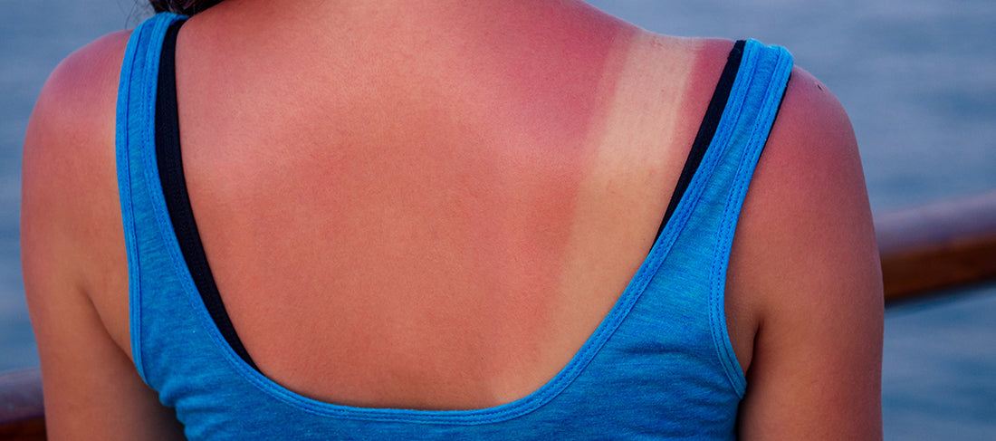 Top 9 natural ways to de-tan your skin this summer