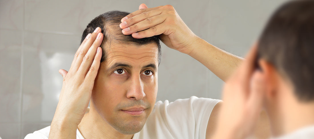 What Is The Role DHT In Hair Loss?