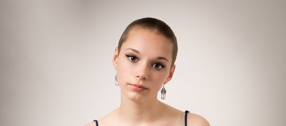 What causes baldness in teenagers?