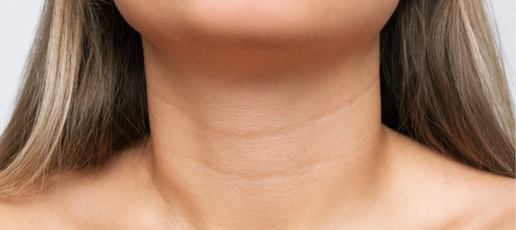 Can Using a Phone Lead to Fine Lines and Wrinkles on Neck?