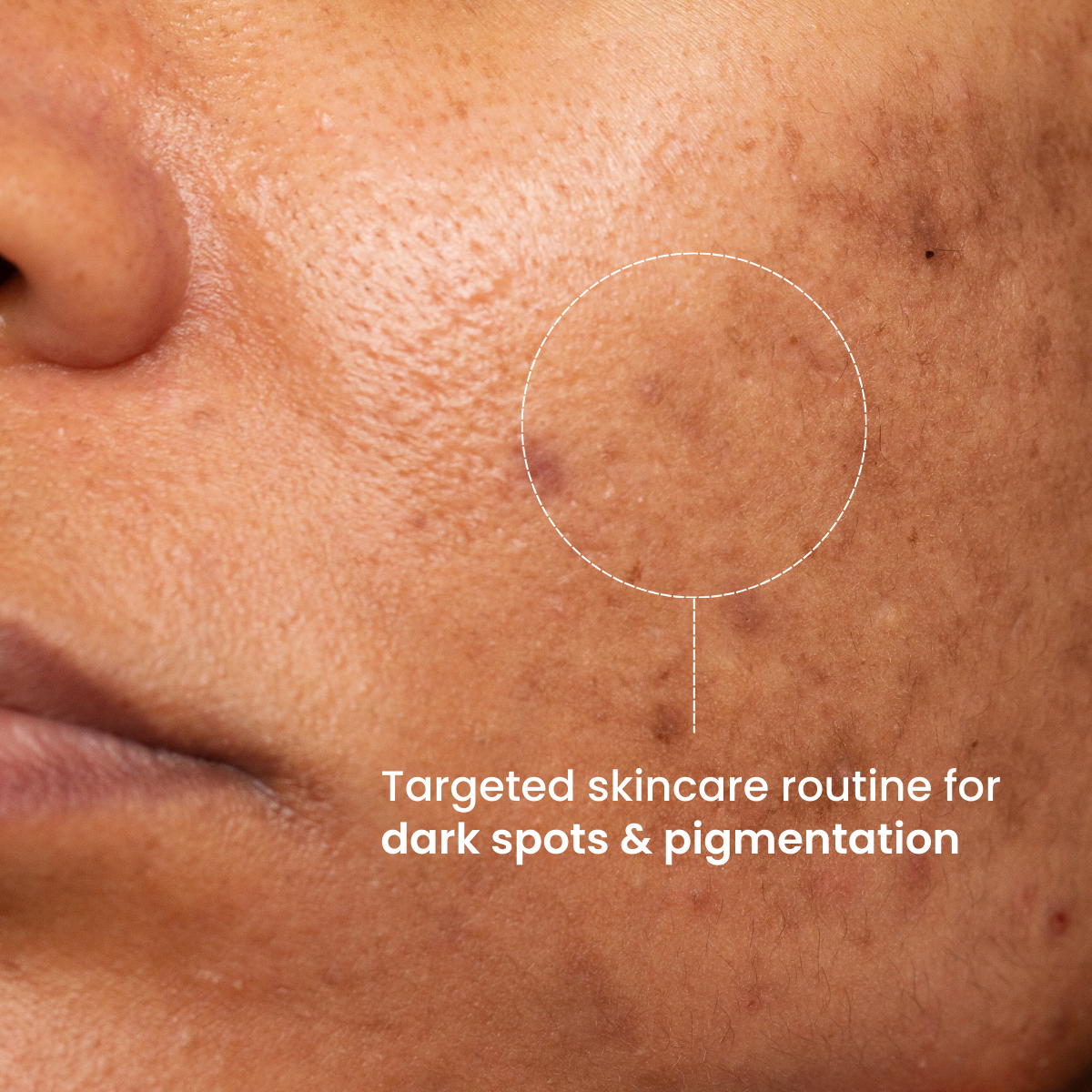 Pigmentation & Dark Spots Treatment Bundle