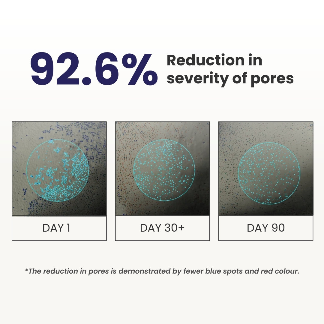 0.3% Retinol Night Cream