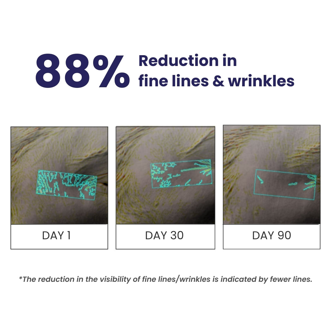 0.1% Retinol Night Cream